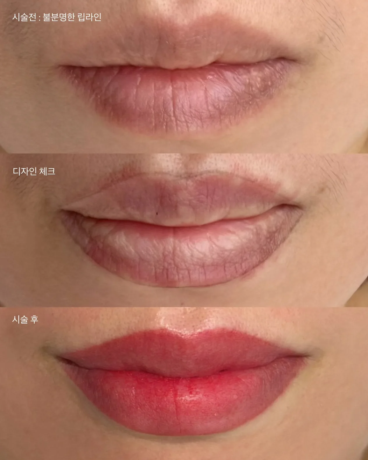 입술반영구 전후 비교 — 시술 전 물분필터, 디자인 체크, 시술 후
