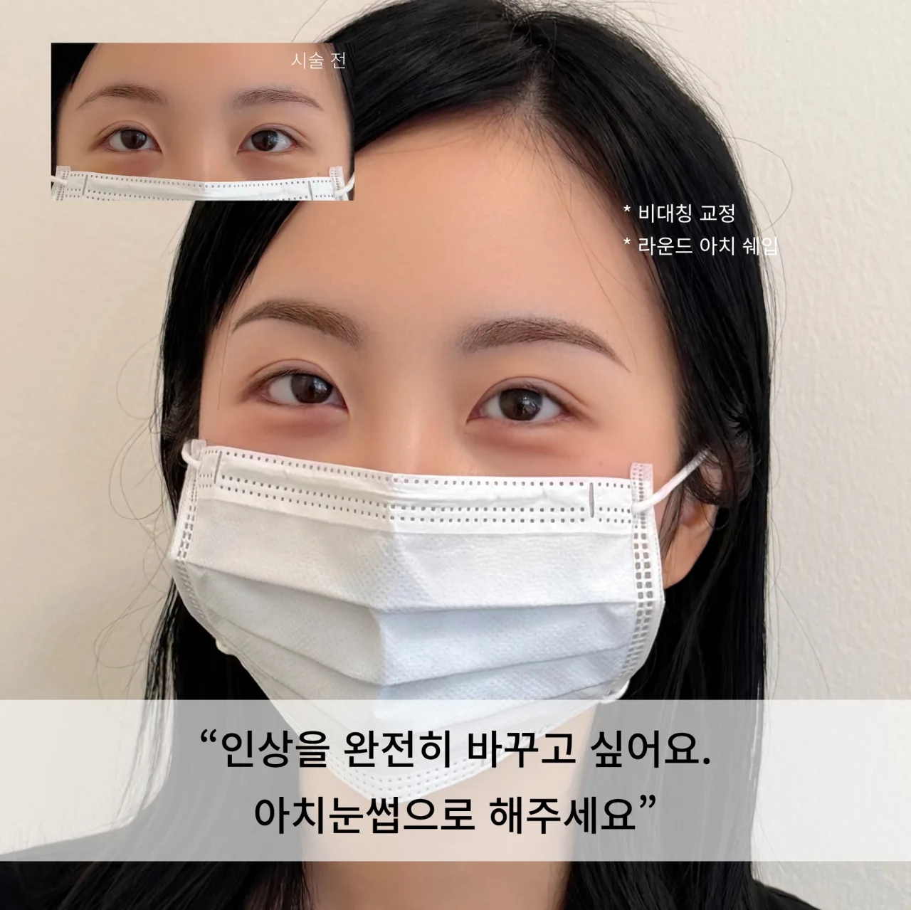 눈썹문신 전후 비교 — 인상을 완전히 바꾸고 싶어요, 아치눈썹으로 해주세요