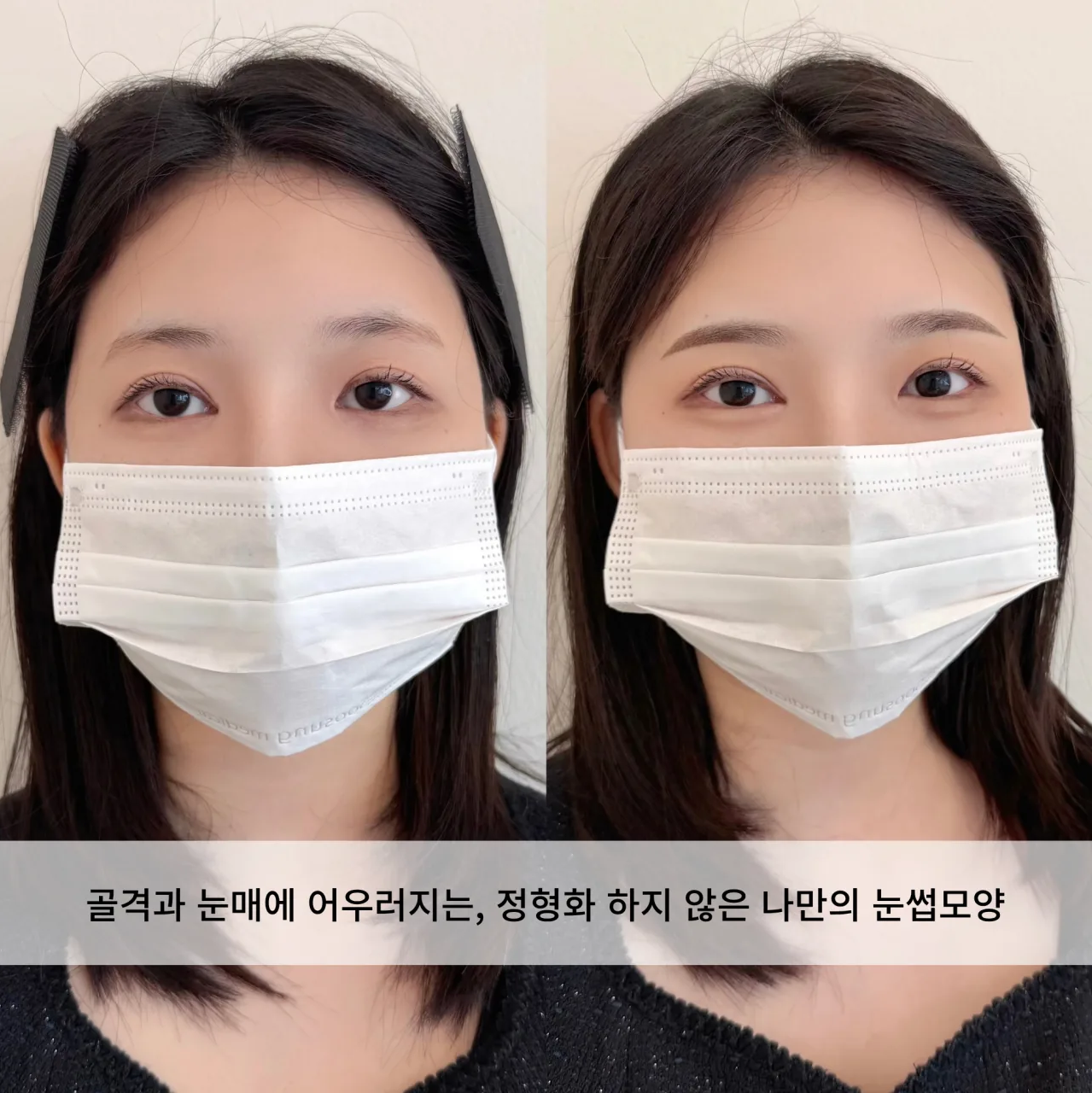 눈썹문신 전후 비교 — 골격과 눈매에 어우러지는 나만의 눈썹 모양