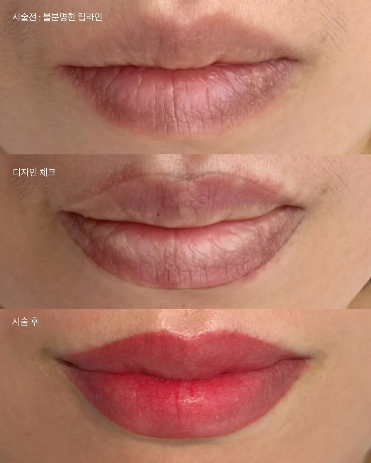 입술반영구 전후 비교 — 시술 전 물분필터, 디자인 체크, 시술 후