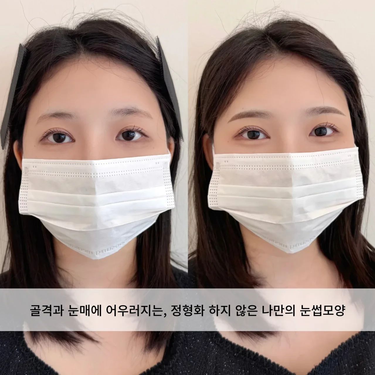 눈썹문신 전후 비교 — 골격과 눈매에 어우러지는 나만의 눈썹 모양
