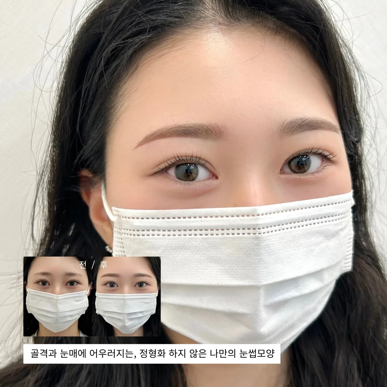 눈썹문신 전후 비교 — 골격과 눈매에 어우러지는 디자인