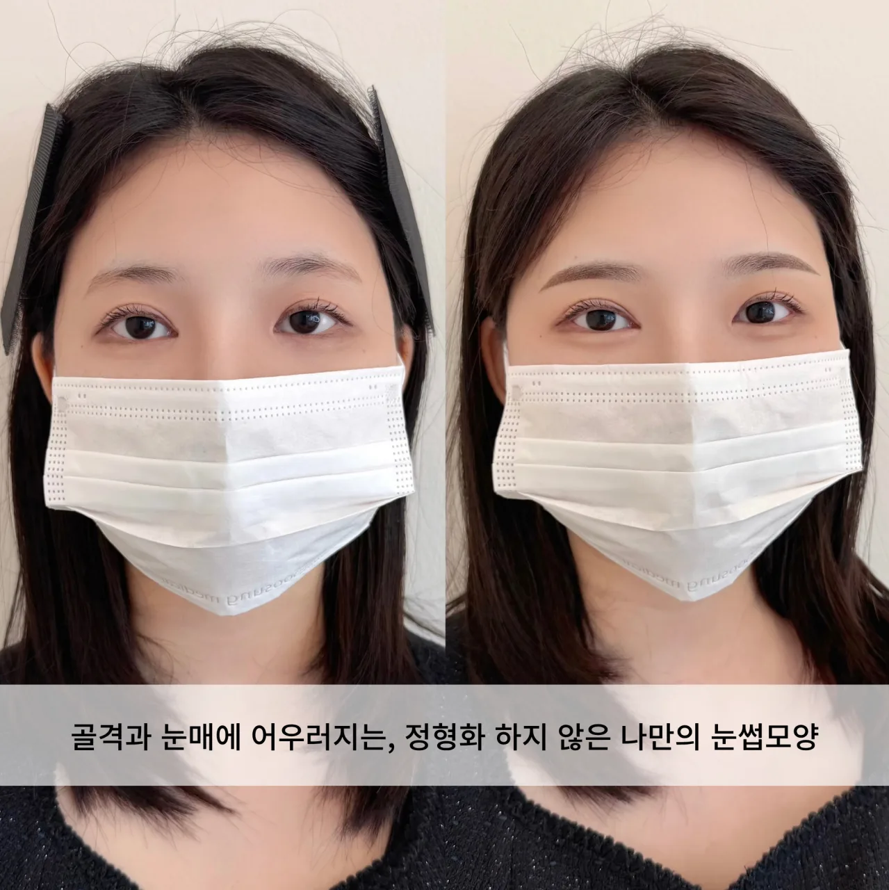 눈썹문신 전후 비교 — 골격과 눈매에 어우러지는 나만의 눈썹 모양