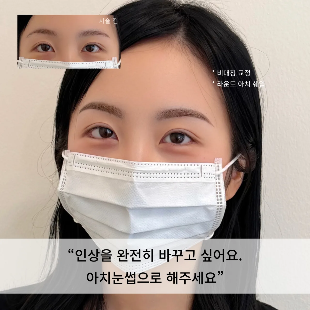 눈썹문신 전후 비교 — 인상을 완전히 바꾸고 싶어요, 아치눈썹으로 해주세요