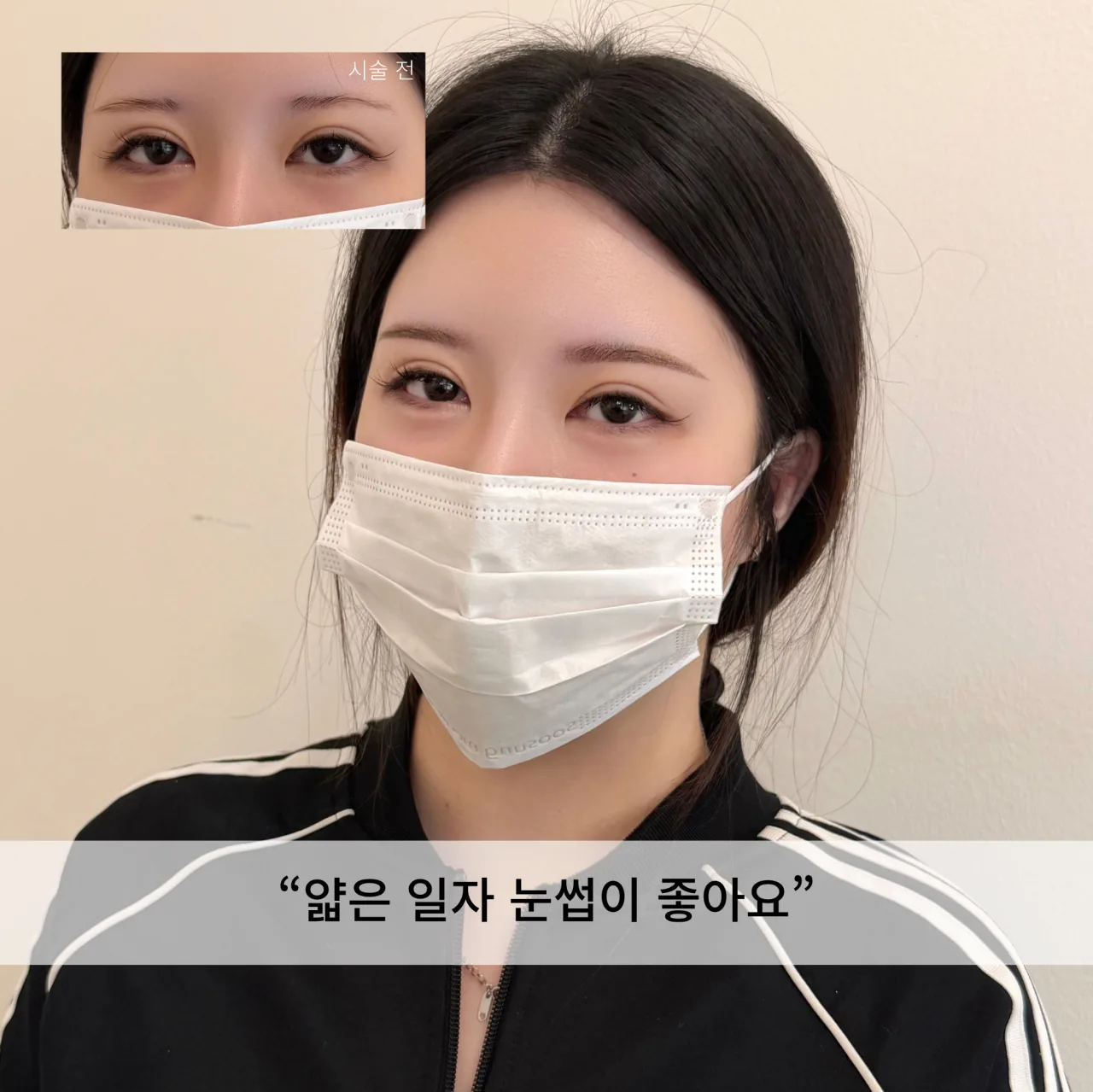 눈썹문신 전후 비교 — 얇은 일자 눈썹이 좋아요
