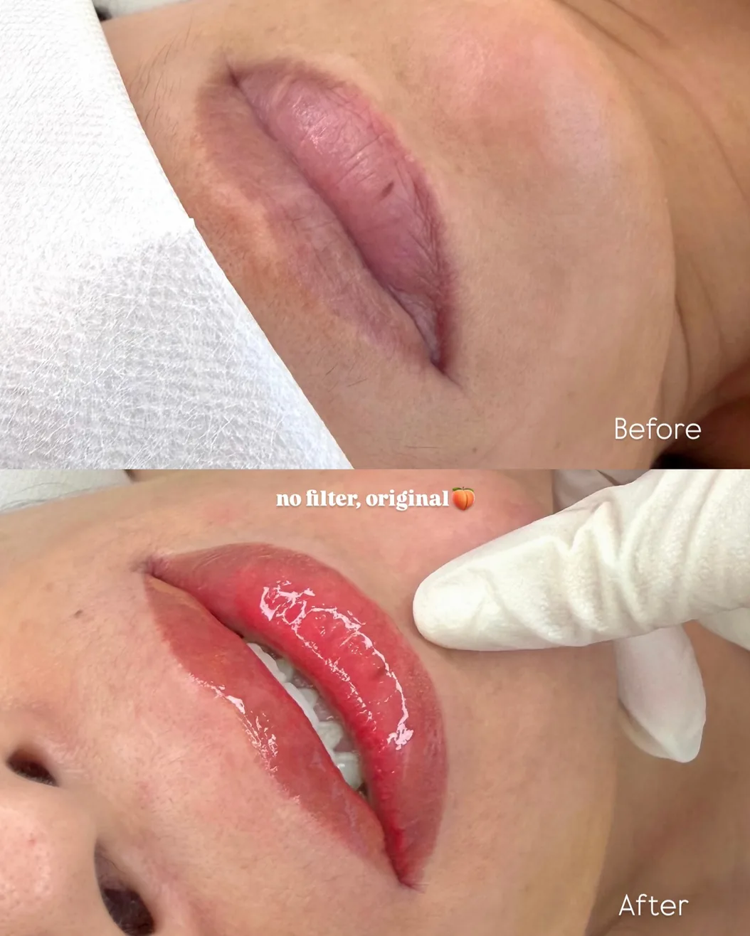 입술반영구 전후 비교 — Before · After
